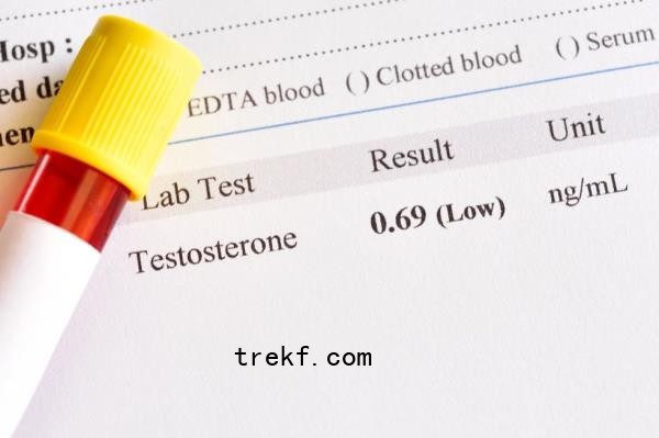 testosterone lab results test